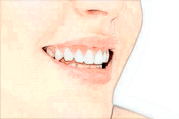 2024重慶解放軍324醫(yī)院口腔科牙齒美白怎么樣_牙齒美白對(duì)牙齒有傷害嗎