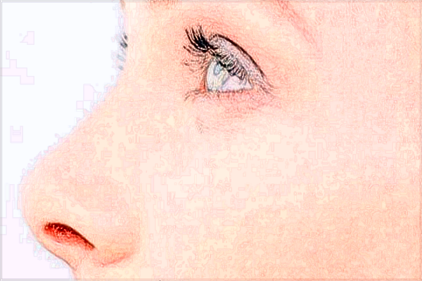 北京麗都做雙眼皮怎么樣?2024北京麗都做雙眼皮價格表