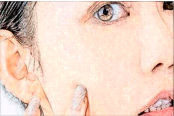 玻尿酸豐面頰會下垂嗎?玻尿酸豐面頰會僵硬嘛?