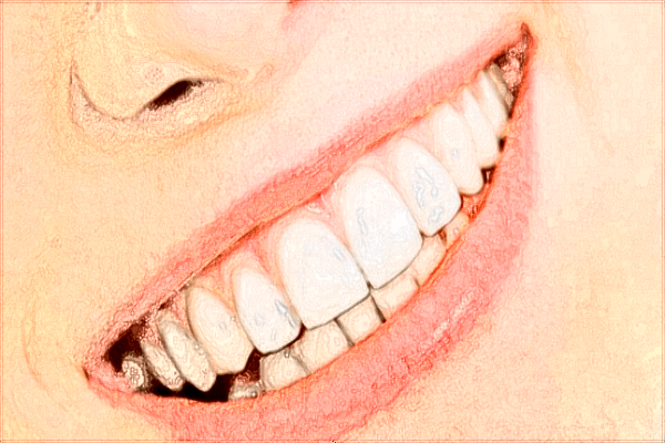 北大醫(yī)院口腔科牙齒美白價(jià)目表(價(jià)格表)怎么樣