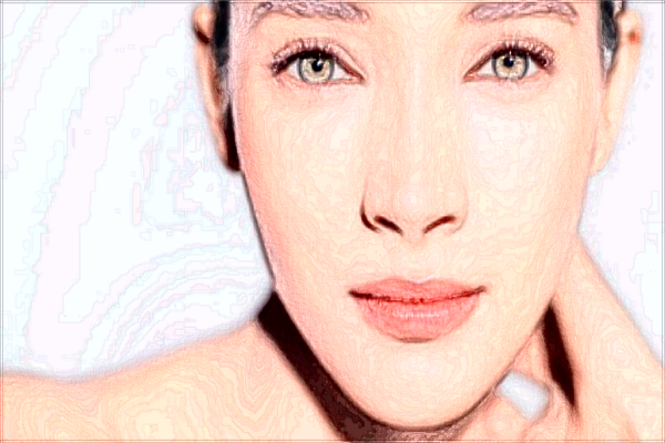 玻尿酸豐面頰會腫嗎?玻尿酸豐面頰會移位嗎?