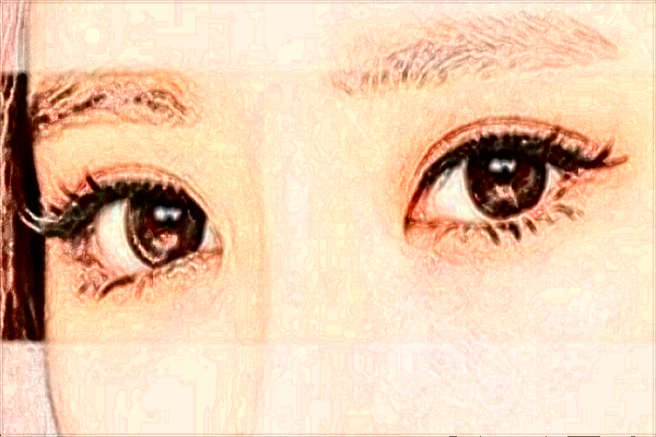 北京潤美玉之光開眼角怎么樣【附開眼角案例】