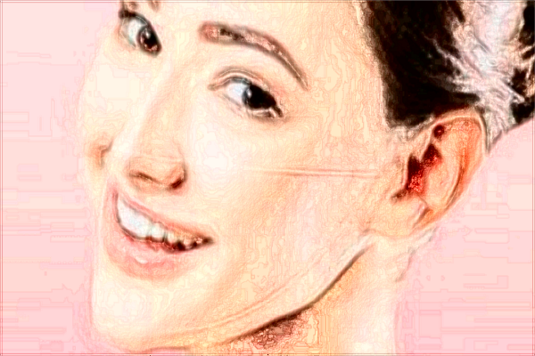 2024-2024交大二院拉皮除皺怎么樣_拉皮除皺手術能保持多少年