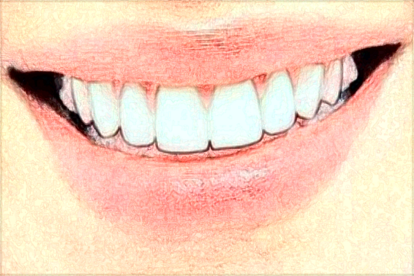 交大二院植牙怎么樣_植牙和鑲牙哪個對身體更好