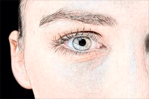 2024潮州華美去眼袋醫(yī)生推薦_怎么樣