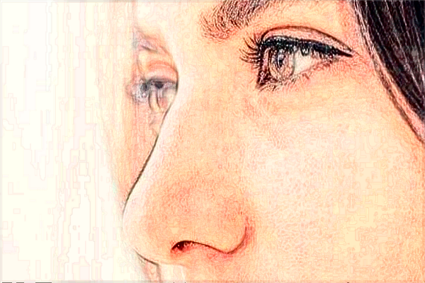 2024北京潤(rùn)美玉之光硅膠隆鼻價(jià)格表_硅膠隆鼻可以維持多少年