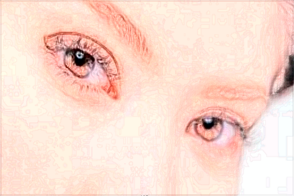 2024北京麗都去眼角細(xì)紋價格表_去眼角細(xì)紋好的方法