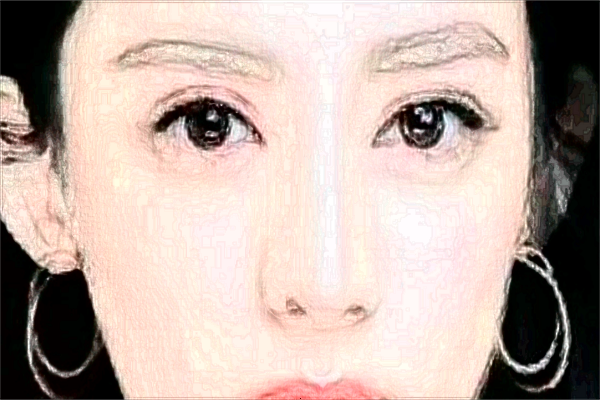 北京潤美玉之光去眼袋怎么樣_哪位醫(yī)生技術好