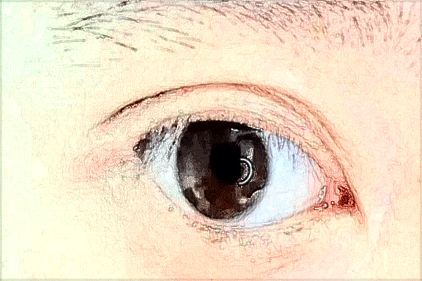 2024安醫(yī)附二院雙眼皮價(jià)格表(價(jià)目表)怎么樣