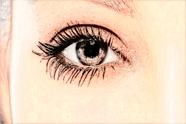 2024浙二院去黑眼圈多少錢_浙二院去黑眼圈激光多少錢