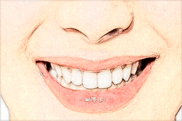 2024浙二院種植牙多少錢_浙二院種植牙有什么風(fēng)險