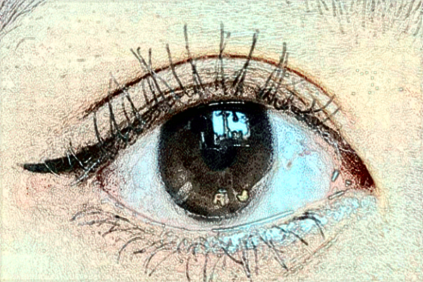 安醫(yī)附二院眼瞼矯正多少錢?眼瞼矯正手術(shù)—般多久恢復(fù)