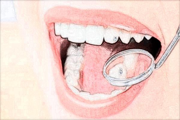 北京大學(xué)口腔醫(yī)院美白牙齒怎么樣_哪位醫(yī)生做的比較好