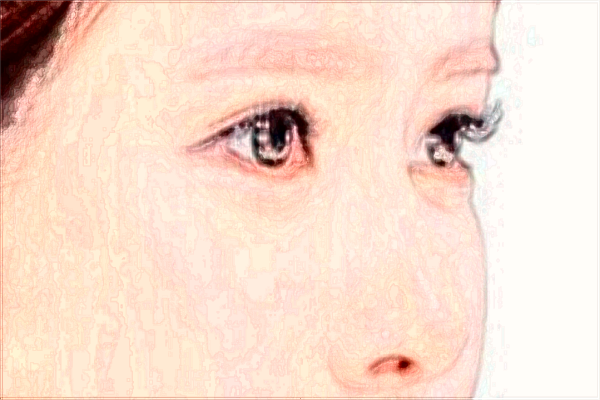 2024隆鼻價(jià)格表公布_交大二院隆鼻技術(shù)怎么樣