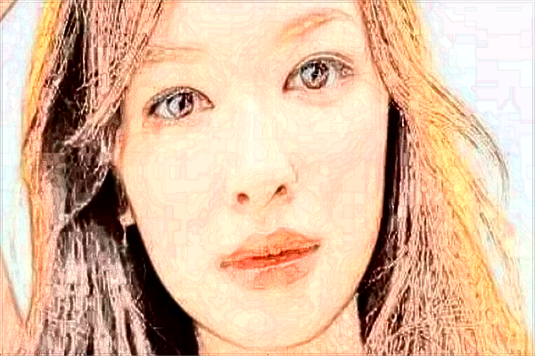 玻尿酸豐面頰多久自然?玻尿酸豐面頰要恢復(fù)多久?