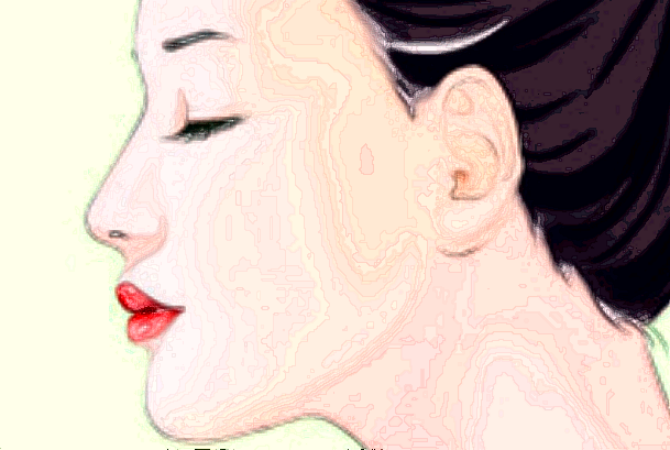 廣州華美光子嫩膚多少錢一次【光子嫩膚案例】