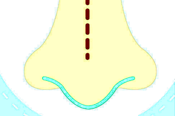 北京美萊怎么樣?一般價格多少錢