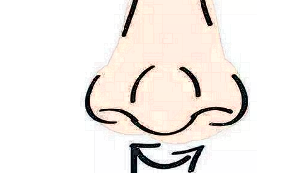 膨體隆鼻有什么后遺癥?膨體隆鼻有風險嗎?