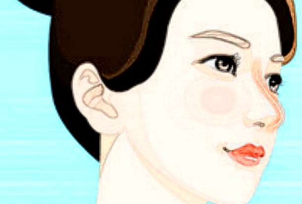 膨體隆鼻需要墊鼻尖嗎?膨體隆鼻需要恢復多久可以自然?