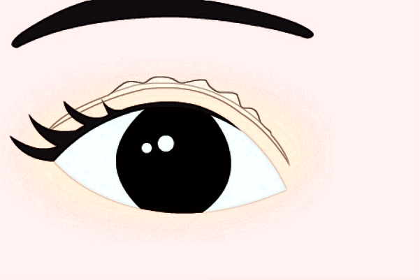 2024做臥蠶收費(fèi)價(jià)格多少_西安二院做臥蠶怎么樣