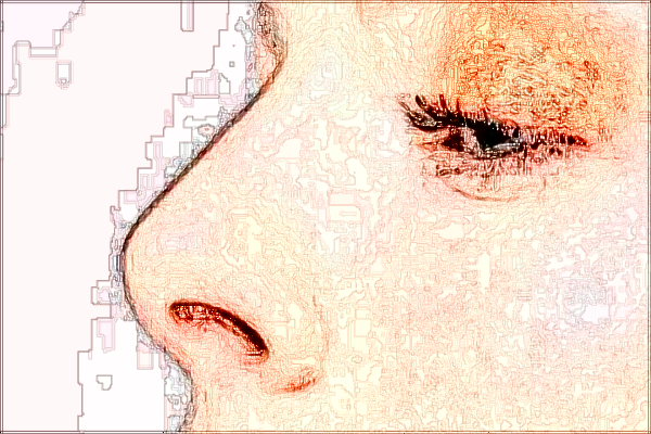 2024四川省人民醫(yī)院隆鼻哪個(gè)醫(yī)生好【隆鼻案例】