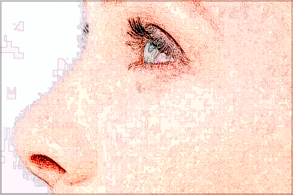 2024四川省人民醫(yī)院隆鼻哪個(gè)醫(yī)生好【隆鼻案例】