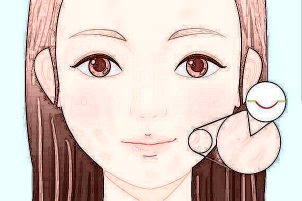 寧波二院去疤痕怎么樣?寧波二院去疤痕收費(fèi)標(biāo)準(zhǔn)