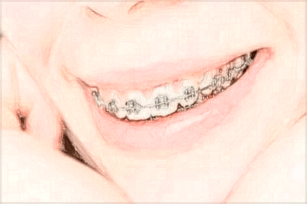 2024四川省人民醫(yī)院口腔科好不好_醫(yī)生技術(shù)哪位好