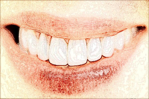 2024四川省人民醫(yī)院烤瓷牙怎么收費_醫(yī)生推薦