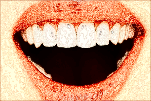 2024四川省人民醫(yī)院烤瓷牙怎么收費_醫(yī)生推薦