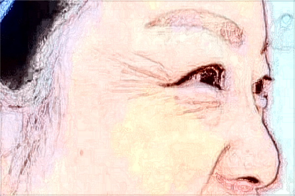 2024威海市立二院自體脂肪填充面部?jī)r(jià)格怎么樣