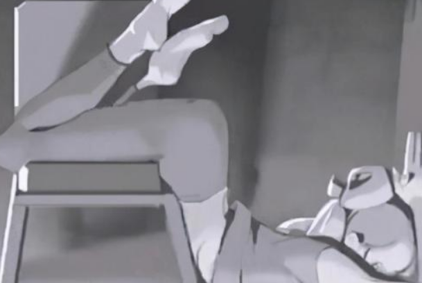 成都格萊麗抽脂做的好不好?大腿抽脂收費(fèi)價(jià)格表2024