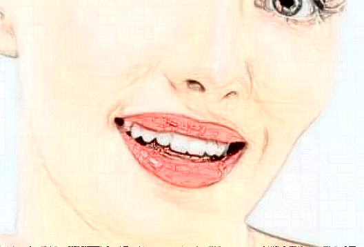 四川省人民醫(yī)院激光祛痣怎么樣_激光祛痣后注意事項