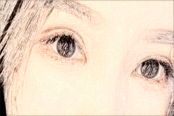 上海華山醫(yī)院光子嫩膚需要多少費用_做的好的醫(yī)生有哪些