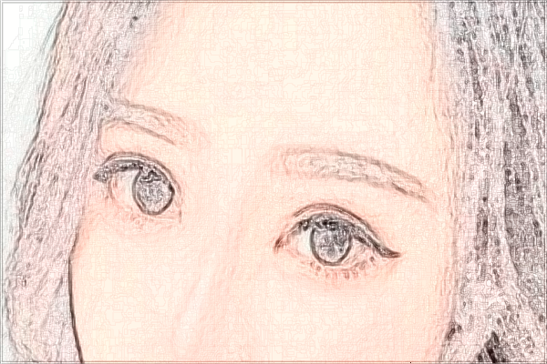 上海華山醫(yī)院光子嫩膚需要多少費用_做的好的醫(yī)生有哪些