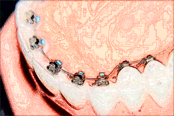 成都華西醫(yī)院口腔科怎么樣_附醫(yī)生名單簡介