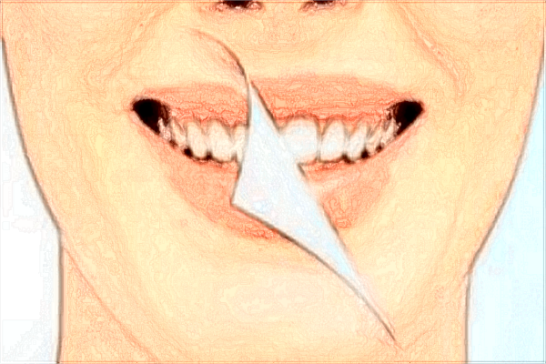 贛南醫(yī)學院第一附屬醫(yī)院口腔科技術怎么樣?收費多少錢?