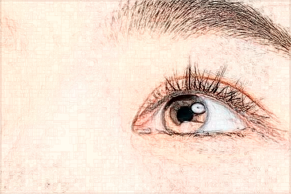 北京大學(xué)第一醫(yī)院激光點痣做的好嗎_哪位醫(yī)生做的比較好