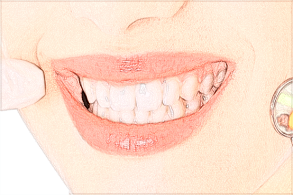 2024北京大學(xué)第一醫(yī)院口腔科焦洋醫(yī)生簡(jiǎn)介_附案例