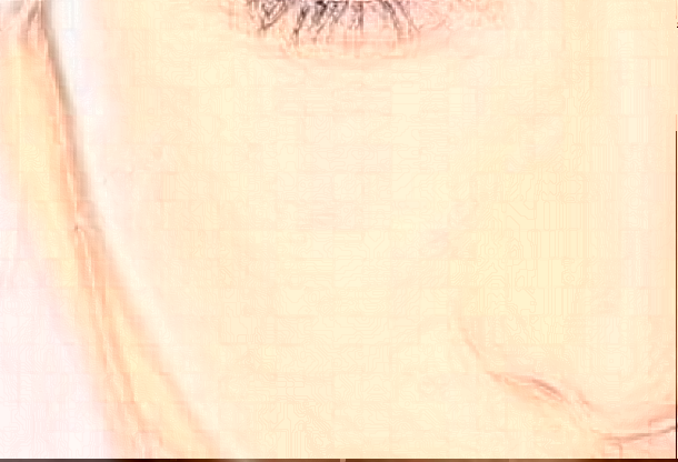 2024北京大學(xué)第一醫(yī)院祛痘價(jià)目表(價(jià)格表)怎么樣