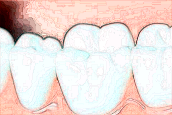 2024南京市中醫(yī)院補(bǔ)牙價(jià)目表(價(jià)格表)十一月上新