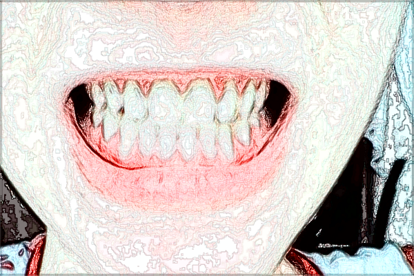 2024上海曙光醫(yī)院種植牙怎么樣_做的好不好