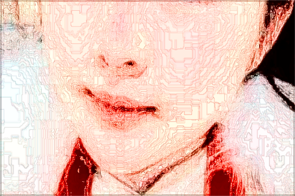 2024上海曙光醫(yī)院去胎記怎么樣_技術(shù)好的醫(yī)生有哪些