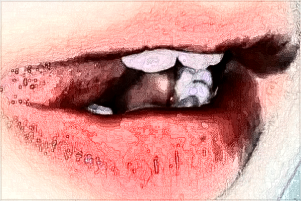 廈門市婦幼保健院口碑怎么樣?廈門市婦幼保健院正畸價(jià)格