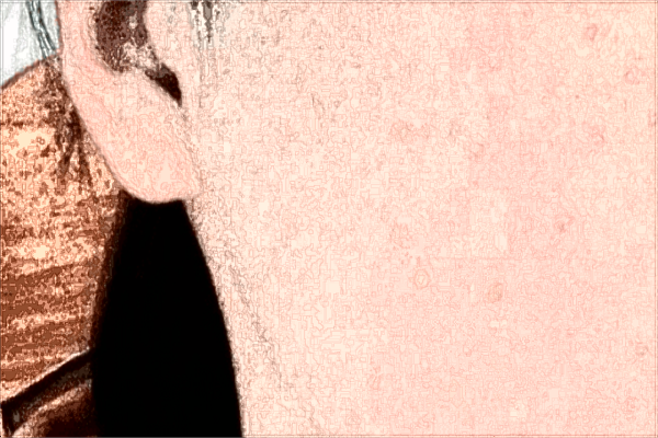 廈門市第一醫(yī)院光子嫩膚收費價格怎么樣?光子嫩膚好不好?