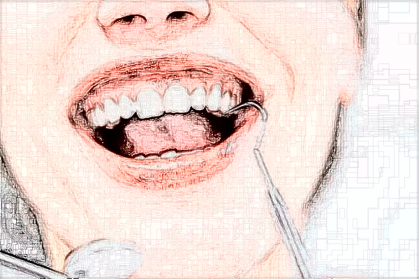 2024四川華西醫(yī)院牙齒矯正做的好嗎?哪位醫(yī)生做的好