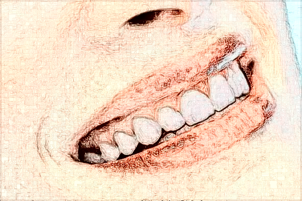 2024四川華西醫(yī)院牙齒矯正做的好嗎?哪位醫(yī)生做的好