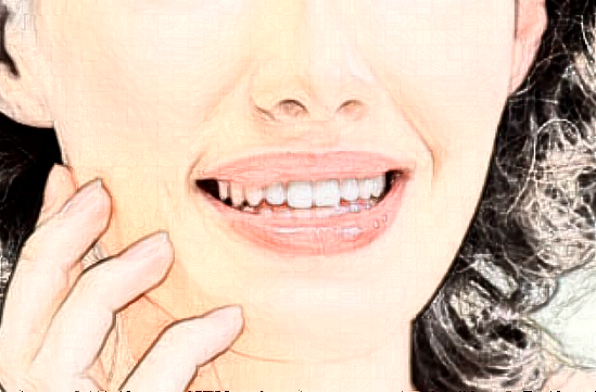 四川華西醫(yī)院鼻子矯正做的好嗎_醫(yī)生推薦