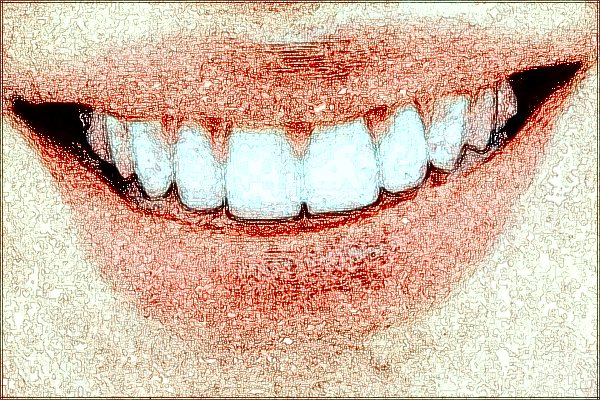 河北省口腔醫(yī)院隱形矯正價(jià)格表_做的怎么樣