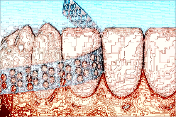 上海曙光醫(yī)院拔牙好不好【拔牙案例】